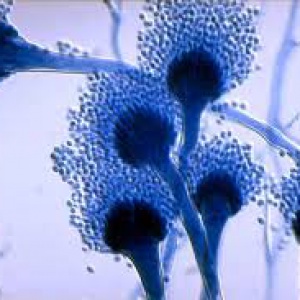 ASPERGILLUS